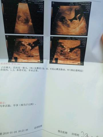 journal_insert_pic_931876207