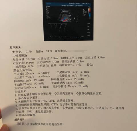 journal_insert_pic_933557634