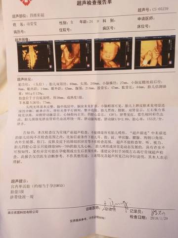 journal_insert_pic_935295134