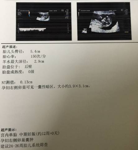 journal_insert_pic_940349886