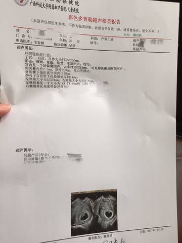 journal_insert_pic_940100891