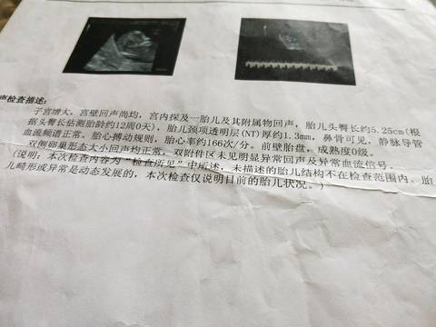 journal_insert_pic_940830102