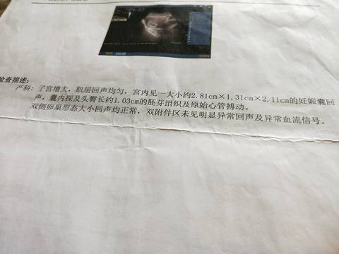 journal_insert_pic_940830091