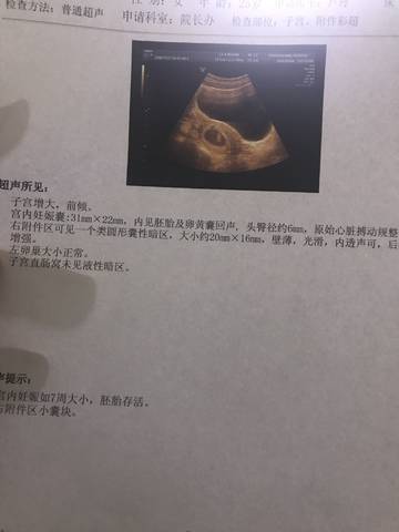 journal_insert_pic_941161524