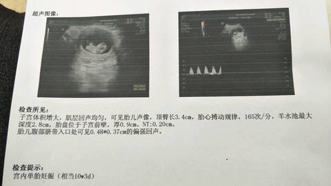 journal_insert_pic_943241507
