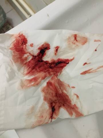 阅读全文 专家回答 医生在线 专家问答 母乳餵养 婴儿辅食 产后护理