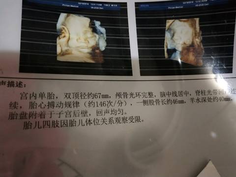 journal_insert_pic_951757458