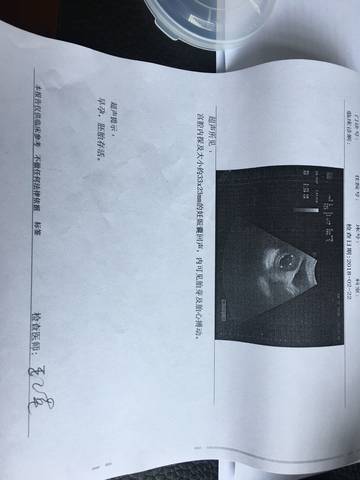 journal_insert_pic_951203098