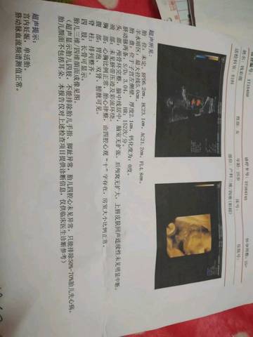journal_insert_pic_953823563