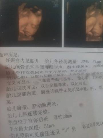 journal_insert_pic_954705280