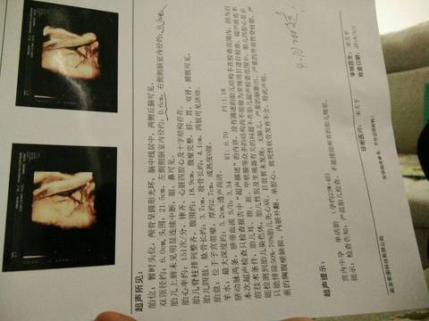 journal_insert_pic_957408792