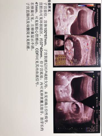 journal_insert_pic_960047313