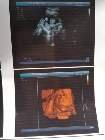 journal_insert_pic_961341249
