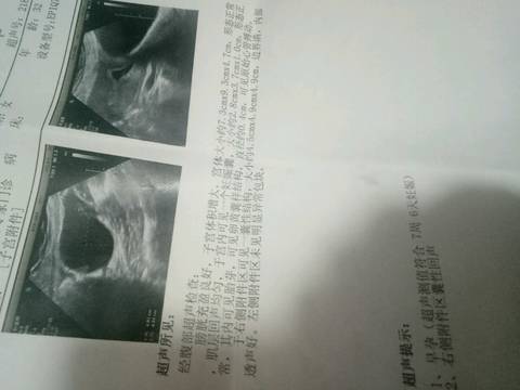 journal_insert_pic_963902559