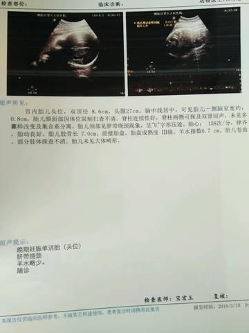 journal_insert_pic_964938235