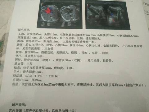 journal_insert_pic_966572428