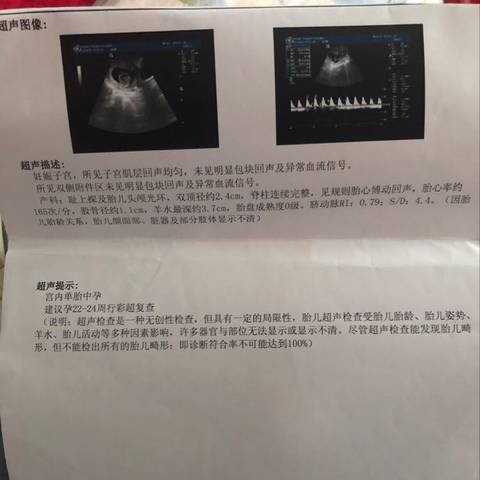 journal_insert_pic_966582604