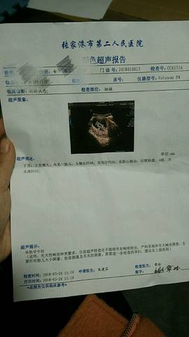 journal_insert_pic_971047448