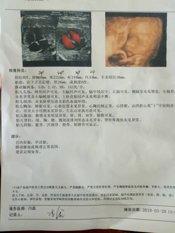 journal_insert_pic_971210630
