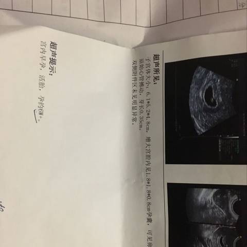 journal_insert_pic_971499331