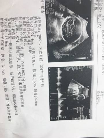 journal_insert_pic_971780453
