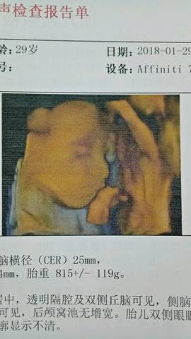 journal_insert_pic_974561543