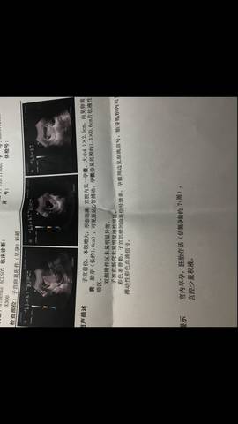 journal_insert_pic_976625344