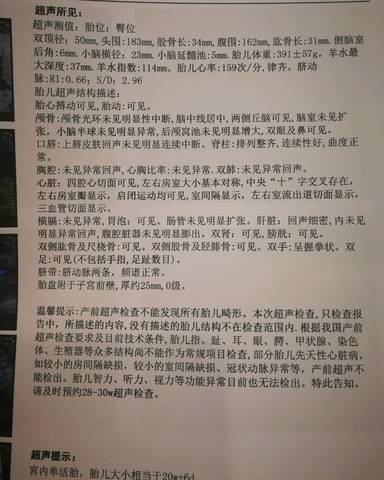 journal_insert_pic_978493101