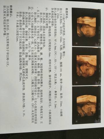 journal_insert_pic_980923588