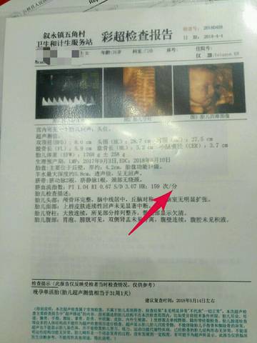 journal_insert_pic_984737216