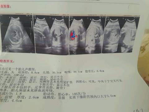 journal_insert_pic_985345159