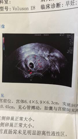 journal_insert_pic_985862652