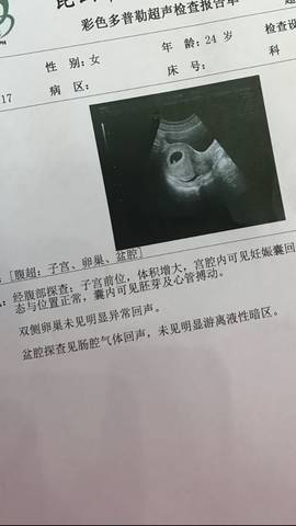 journal_insert_pic_985971726