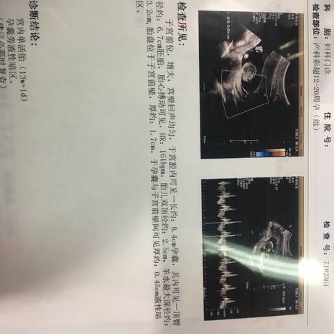 journal_insert_pic_986868868