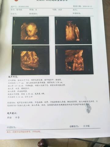 journal_insert_pic_987370395