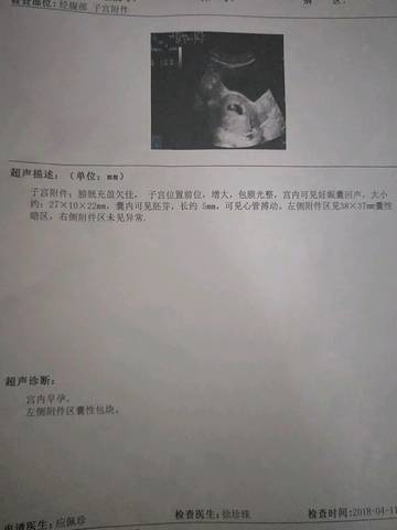 journal_insert_pic_987489093
