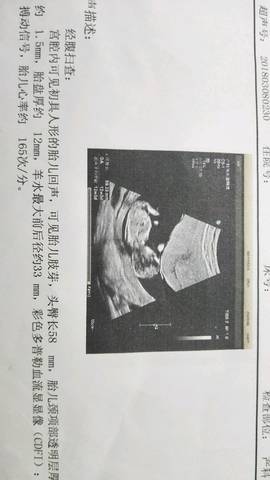 journal_insert_pic_987954485