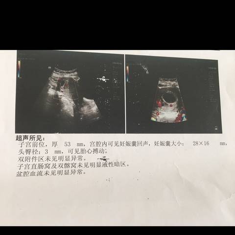 journal_insert_pic_988088444