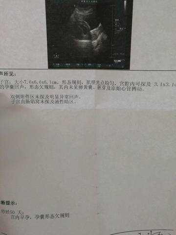 journal_insert_pic_988926003