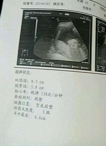 journal_insert_pic_990353397