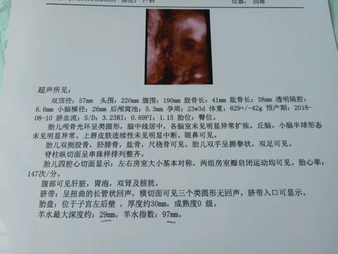 journal_insert_pic_991048271