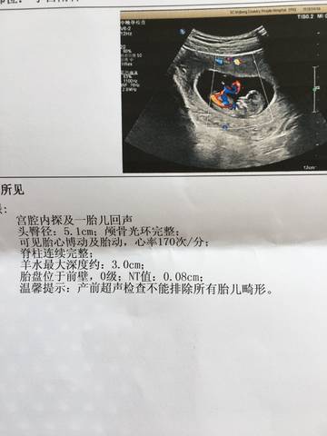 journal_insert_pic_991025024