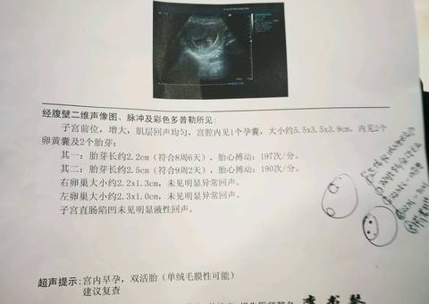 journal_insert_pic_991220403