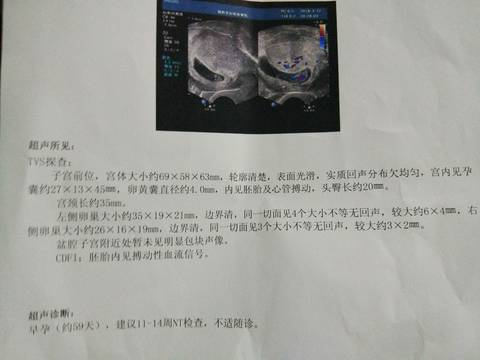 journal_insert_pic_992057336