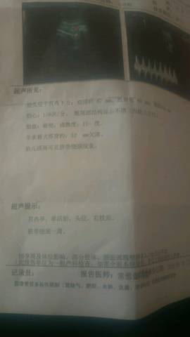 journal_insert_pic_991611781