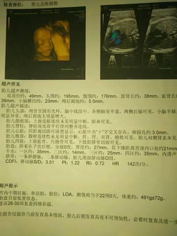 journal_insert_pic_992383148