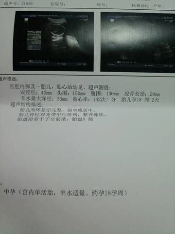 journal_insert_pic_992824004