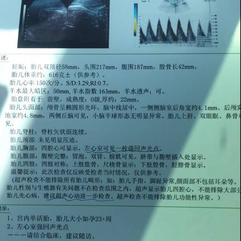 journal_insert_pic_992367086