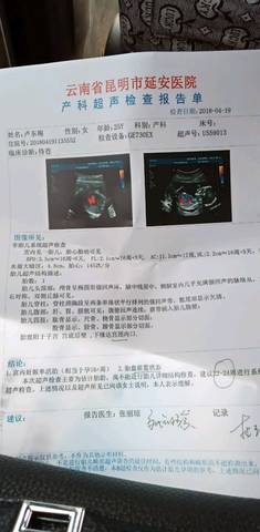 journal_insert_pic_993220503