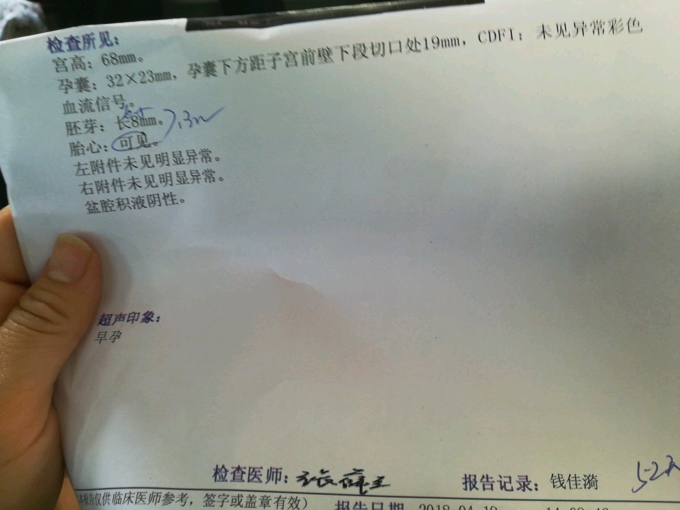 来还愿了。刚出来的胎心胎芽